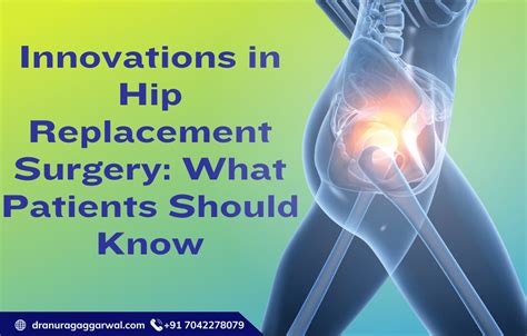 Innovations in Hip Replacement Surgery Patiets Must Know