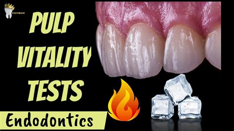 Endodontics Pulp Vitality Tests Made Easy Youtube