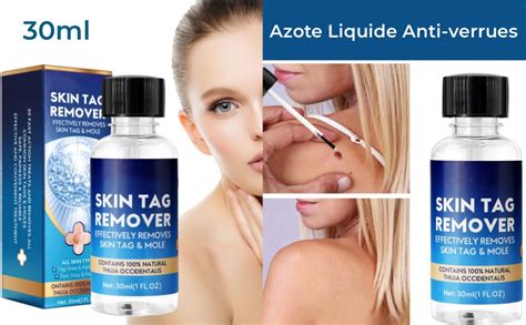 Azote Liquide Anti Verrues Acrochordons Traitement Efficace