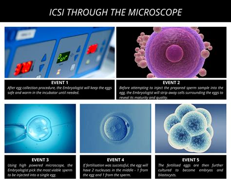 Icsi Process Kl Fertility Centre