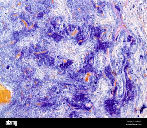 Posterior pituitary gland, light micrograph Stock Photo - Alamy