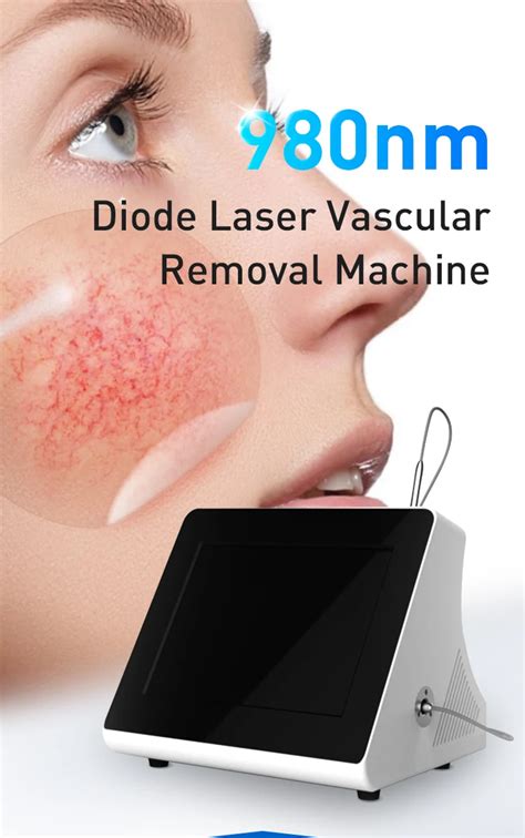 Portable Red Blood Vessels Spider Vein Removal Nm Diode Laser