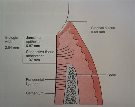 Dental-Revue | Справочник | Биологическая ширина (biological width).