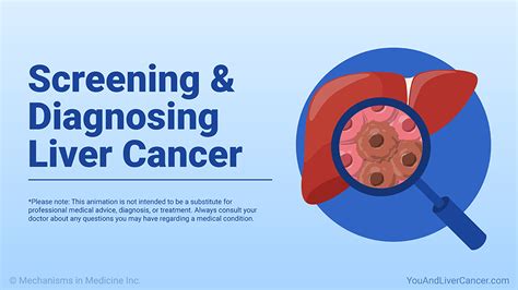 Screening And Diagnosing Liver Cancer — Animation