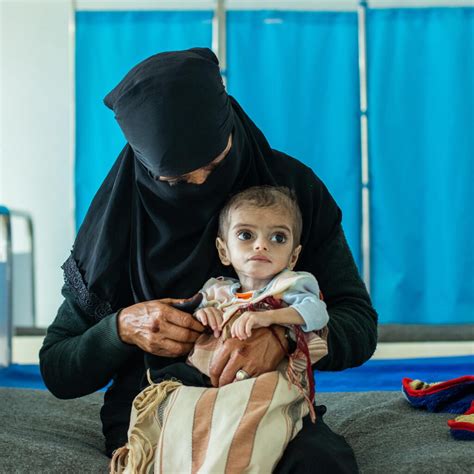 UNICEF Yemen on Twitter: "#Malnutrition is robbing millions of children ...