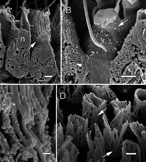 Scanning Electron Micrographs Of 01 ␮ M Latex Beads On Collars And