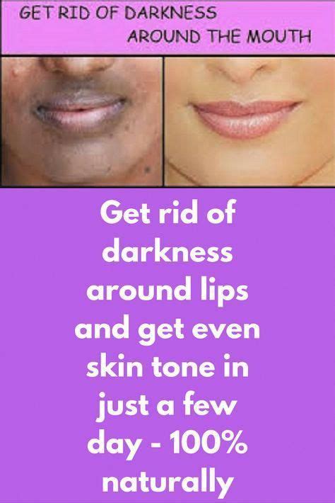 Pin On Skin Whitening Treatment For Dark Skin