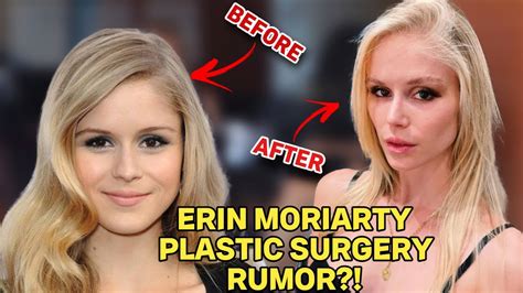 The Truth About Erin Moriarty Plastic Surgery Her Dating Life More