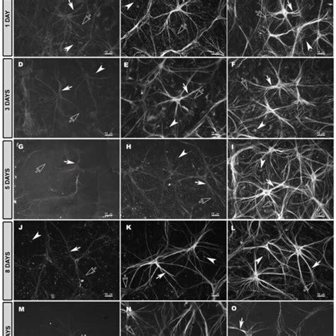 Retinal Whole Mount Double Immunostaining For Gfap Red And Mhc Ii