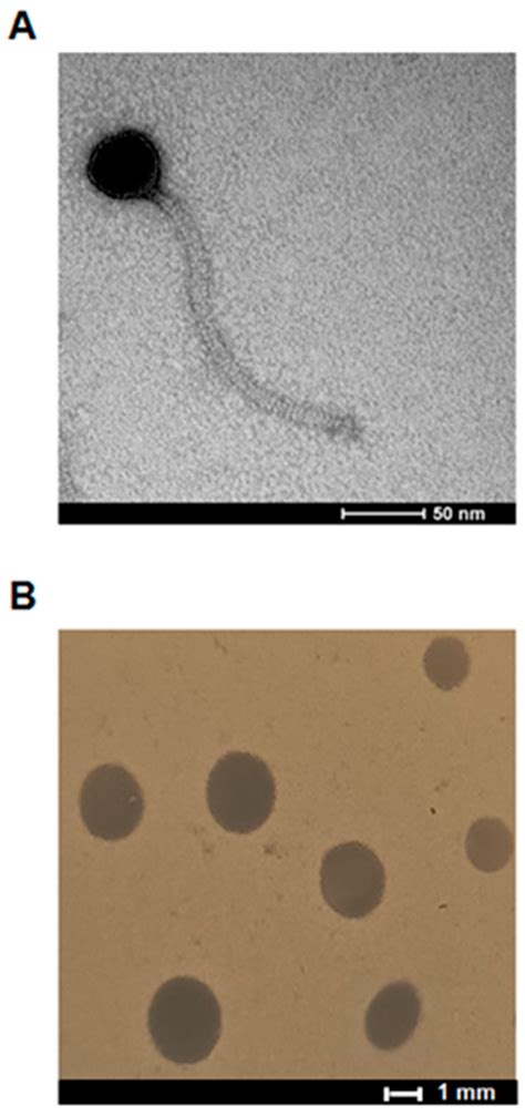 Enterococcus Faecalis Gram Stain Morphology