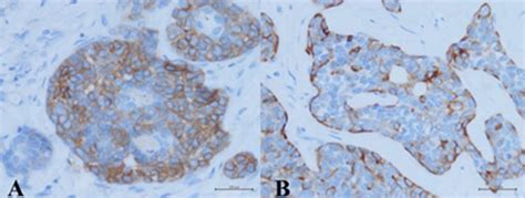 Immunohistochemistry Study Revealed Two Different Cell Populations The