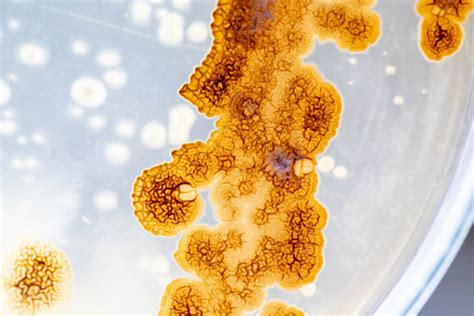 2,400+ Mold Penicillin Aspergillus Penicillium Stock Photos, Pictures ...