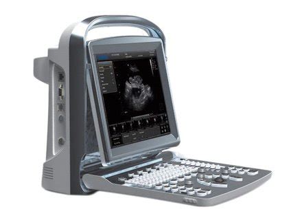 CHISON ECO 1 VET ULTRASOUND ChMedica