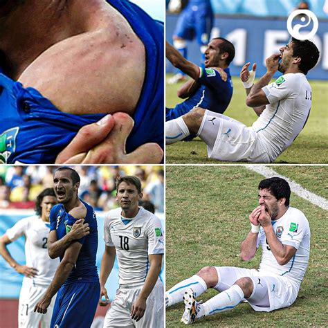 Luis Suarez Bite Chiellini