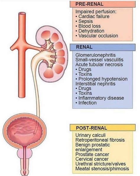 Causes Of Renal Failure Medizzy