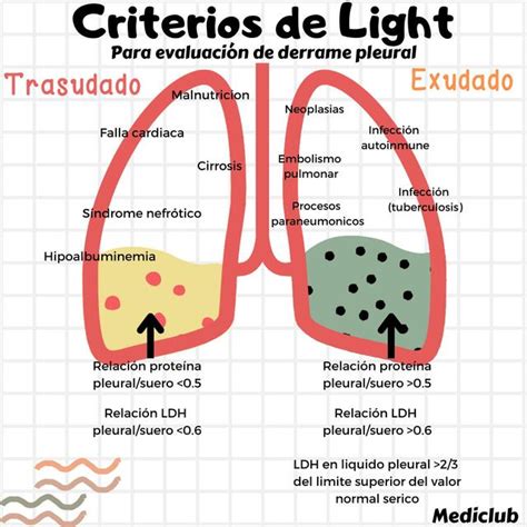 Criterios De Light MEDICLUB UDocz