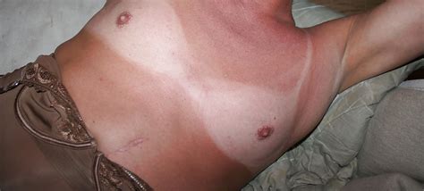 Tan Line Porn Pictures Xxx Photos Sex Images Pictoa