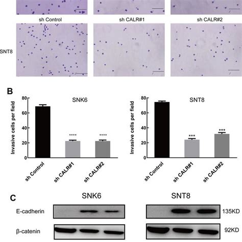 Calr Knockdown Inhibits G To S Phase Cell Cycle Transition In Nktcl