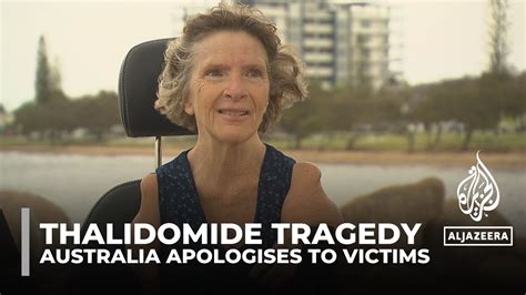 Thalidomide Survivors Australia Apologises To Victims Of Drug The Global Herald