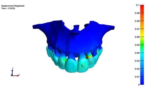 Researchers Use Digital Twin To Train AI On Tooth Movements