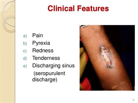 Acute And Chronic Osteomyelitis Infection Of Bone