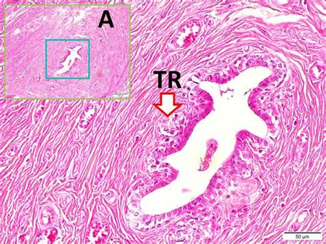 Histological Appearances Of The Mammary Gland In A Pregnant Rat At Low