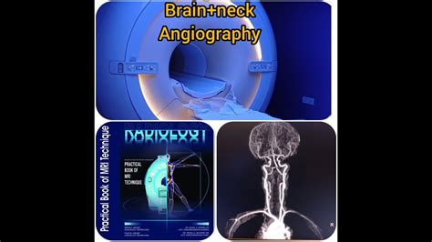 Mri Brain Neck Angiography With Bolus Tracking On Philips T Youtube