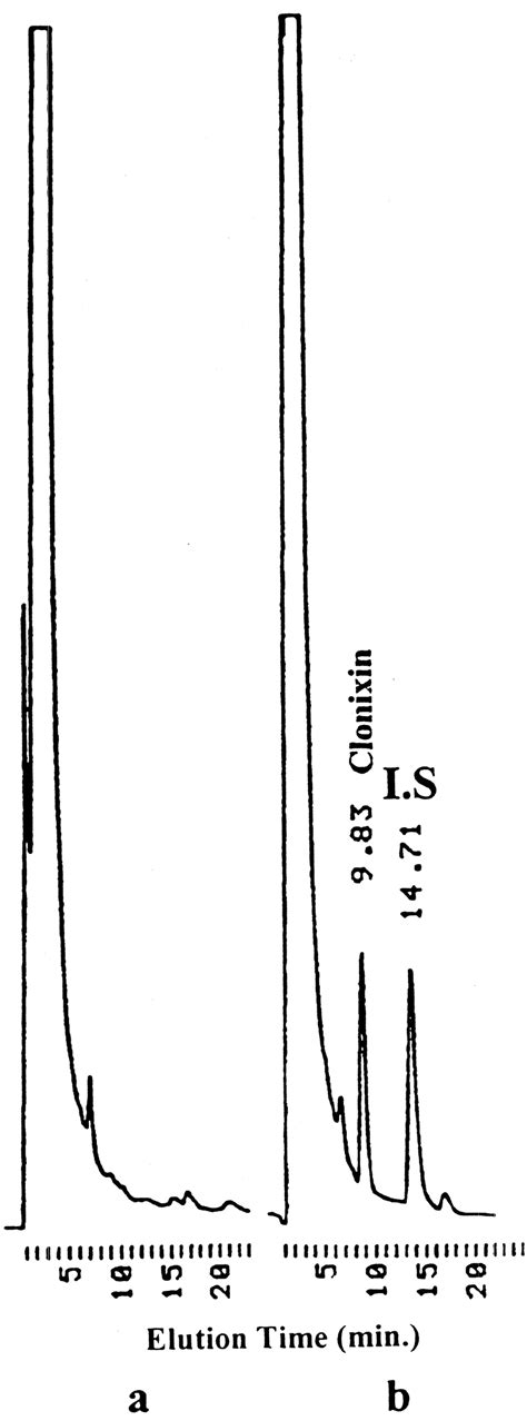 Typical Chromatograms Of A Blank Plasma Sample A A Plasma Spiked