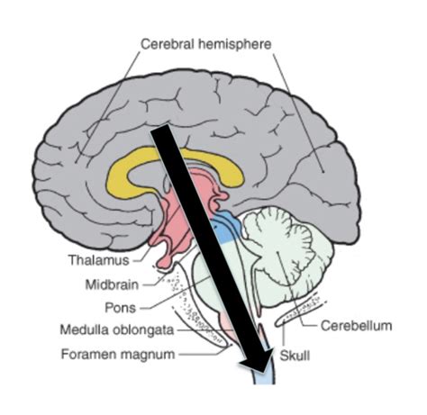 Nbbs Neuroscience All Lectures Flashcards Quizlet