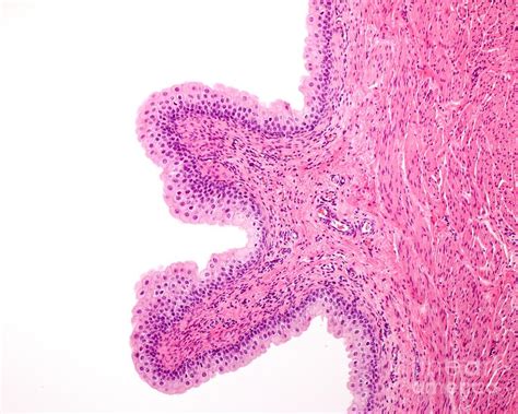 Urinary Bladder Mucosa Photograph By Jose Calvo Science Photo Library