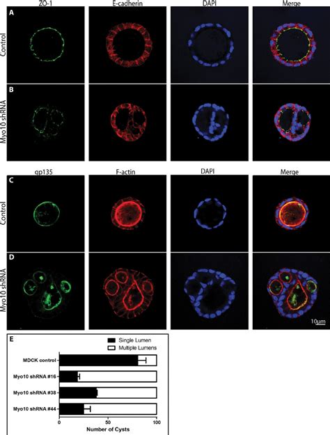 Myo Knockdown Leads To The Formation Of Cysts With Multiple Lumens