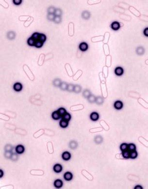 The Location of Ribosomes in a Cell | Education - Seattle PI