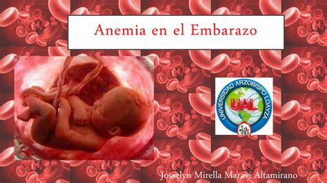 Anemia En El Embarazo Ppt Ppt Descarga Gratuita