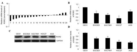 Ror2 Inhibits The Proliferation Of Gastric Carcinoma Cells Via