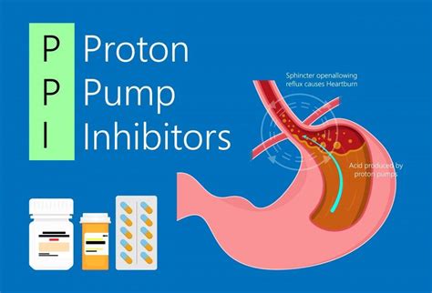 The Benefits Of Coming Off A Proton Pump Inhibitor Avraham Belizon Md