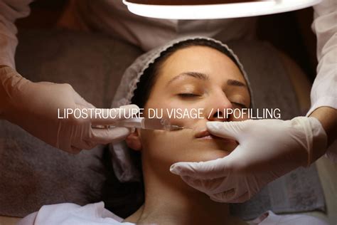 Lipostructure Du Visage Lipofilling Docteur Duch Avignon