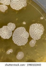 Closeup Bacteria Bacillus Subtilis Colonies On Stock Photo 1980102443