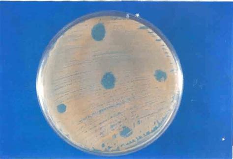 Zone Inhibition Of Staph Aureus Against Supernatant Of Lacto Species