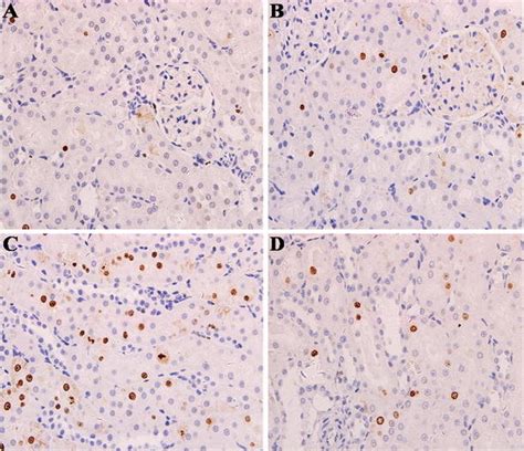 Tripterysium Glycosides Preconditioning Could Alleviate Renal Tubular