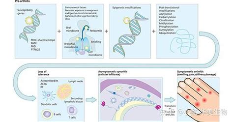 细胞因子和类风湿性关节炎 知乎