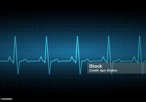 Ilustración De Gráfico De Frecuencia Cardíaca Latidos Del Corazón Onda De Icono De Ekg Color