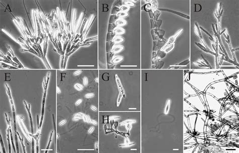 Photomicrographs Of Living Trichomycetes