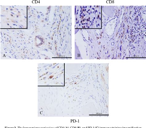 Figure 2 From Characterization Of Pd 1pd L1 Immune Checkpoint