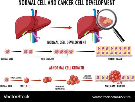 Diagram Showing Cancer Development Process Vector Image