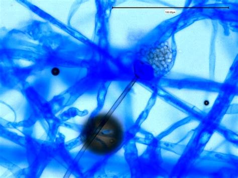 Fun With Microbiology What S Buggin You Apophysomyces Elegans