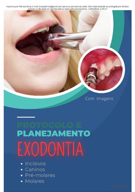 Protocolo E Planejamento Exodontia Todos Os Dentes Superiores E