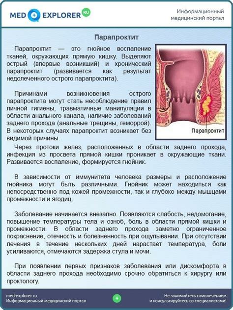 Лечение наружного геморроя в домашних условиях