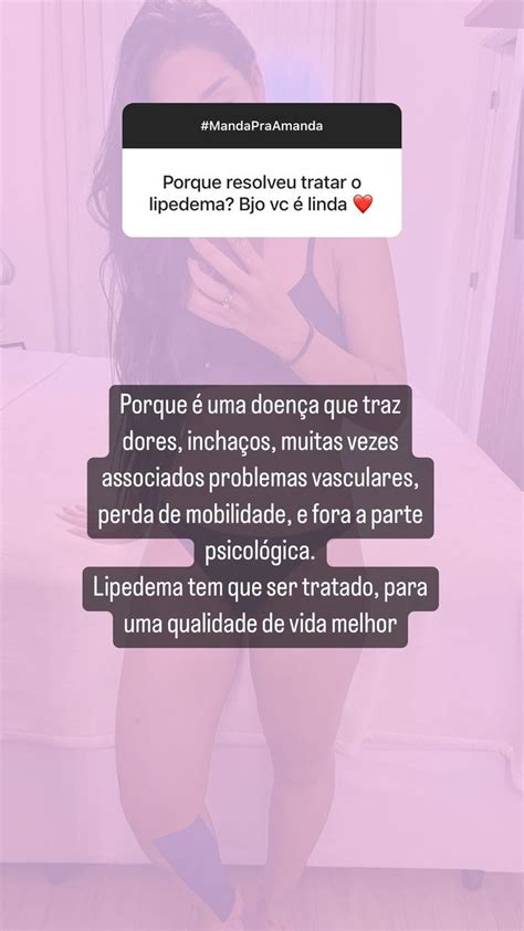 Amanda Djehdian Esclarece D Vidas Sobre Cirurgia De Lipedema