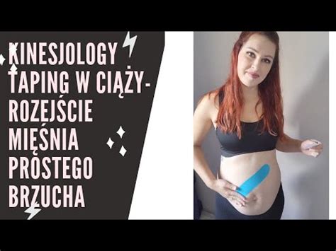 Kinesiology Taping W Ci Y Zapobieganie Rozej Ciu Mi Nia Prostego