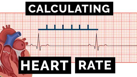 Calculating Heart Rate On An Ecg Ekg Osce Guide Ukmla Cpsa Plab 2 Youtube